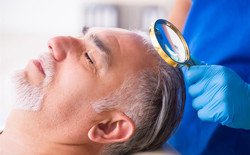 family support during hair transplant recovery
