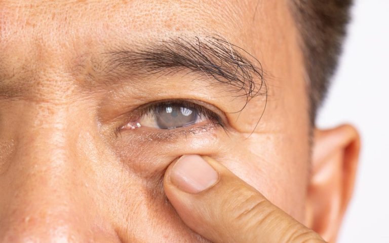 See Nashville in Full Color Again: How Cataract Surgery Brings Back What You’ve Missed