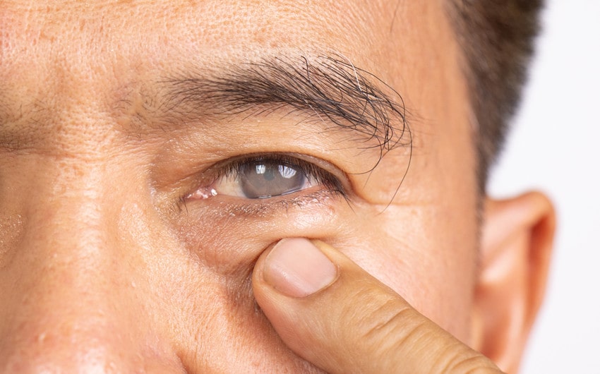 Cataract Surgery Brings Back What You’ve Missed