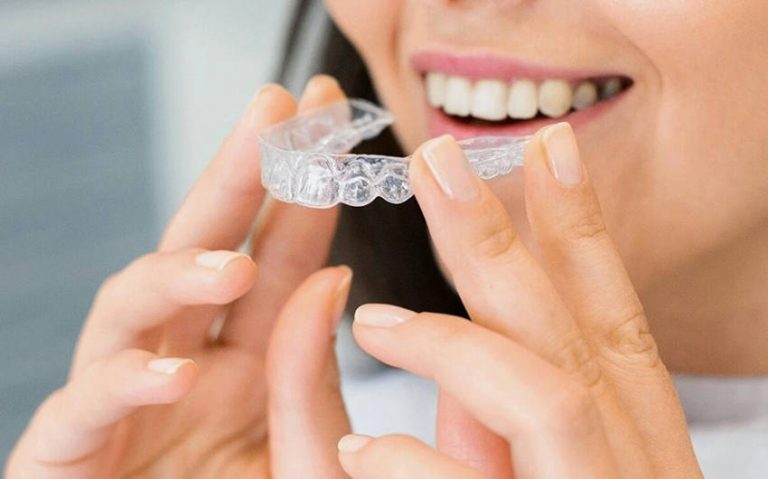 Complete Guide to Caring for Invisalign Aligners Properly
